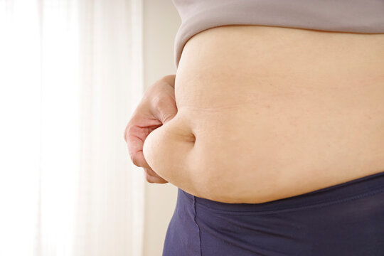 ぽっこりお腹と皮下脂肪を気にする女性