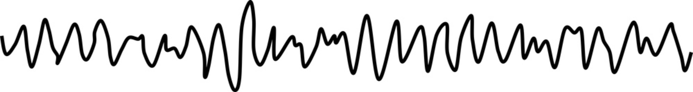 心室細動のグラフィック素材イラスト