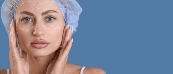 Young woman with marks on her face against blue background, closeup. Blepharoplasty concept