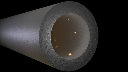 Biofilm accumulation inside tube. Clog in pipe. Atherosclerosis. Arterial blockage with plaque, cholesterol, debris buildup. 3d render illustration. 