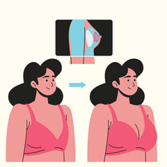 Plastic Surgery woman undergoing breast augmentation surgery to enhance her body shape and boost her confidence-02