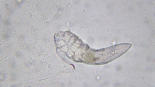 Demodex mite moving and rotating under bright field microscope at 400x magnification