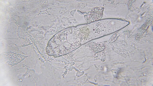 Demodex mite moving under bright field microscope at 400x magnification