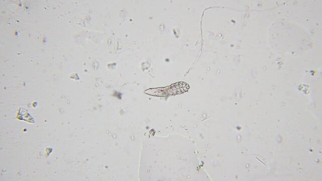 Demodex mite moving under bright field microscope at 100x magnification