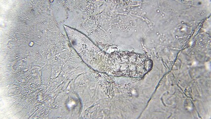 Moving Demodex mite under bright field microscope at 400x magnification