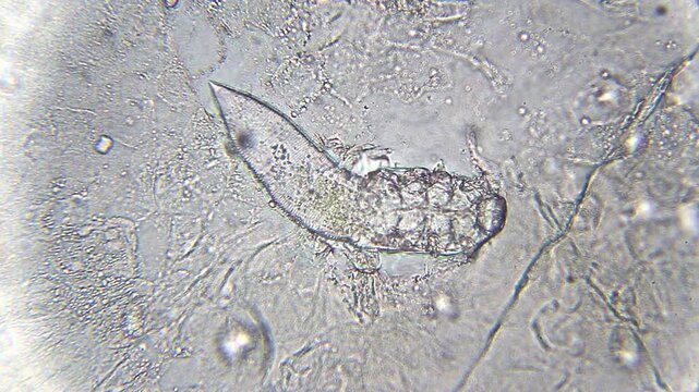 Moving Demodex mite under bright field microscope at 400x magnification