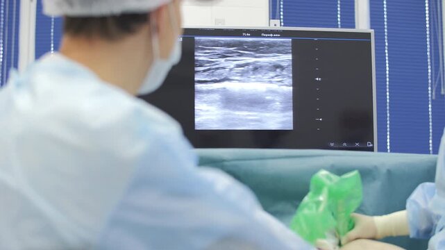 Doctor monitoring vein treatment with ultrasound guidance