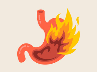 This illustration creatively depicts a burning stomach, symbolizing the discomfort of heartburn, with flames emanating from within the stomach area showcasing irritation.
