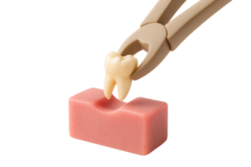 Dental concept of tooth extraction, showing forceps pulling a molar model from a gum replica, isolated