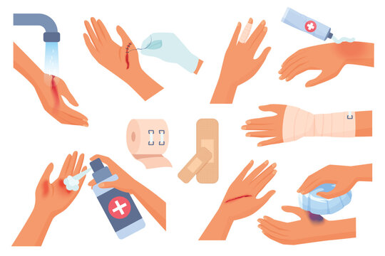 First aid for hand injury set vector illustration. Cartoon isolated injured human arms of patient with wound and burn on skin, hands cleaning trauma with water, using elastic bandage and dressings
