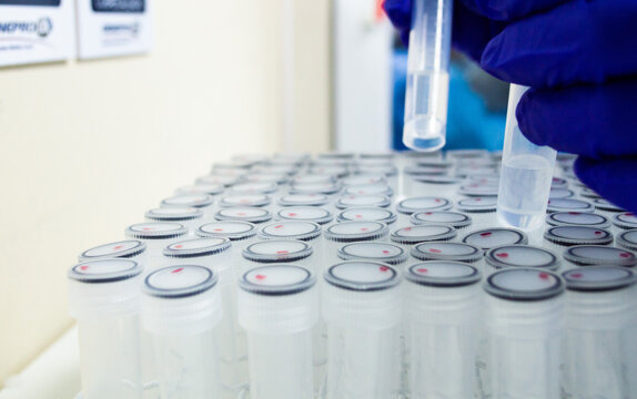 Investigador con guantes azules manipulando tubos Eppendorf en gradilla, procesamiento de alto rendimiento de muestras para diagn&oacute;stico o an&aacute;lisis cient&iacute;fico