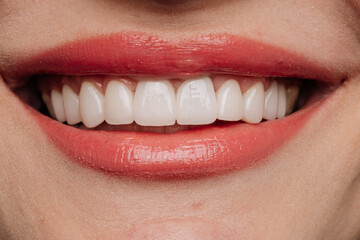 Closeup smile with white porcelain veneers and coral lipstick dental aesthetic beauty
