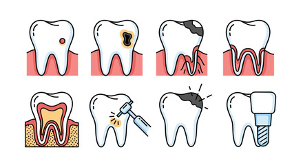 Set of modern outline style icons illustrating dental caries progression and treatment, including cavities, root decay, drilling, and dental implants, presented on a clean white background for