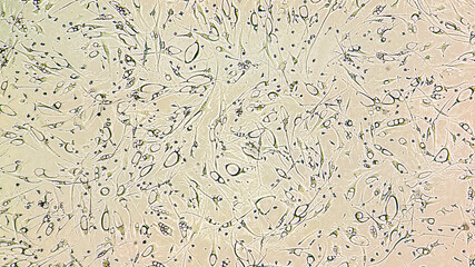 Human glioblastoma cells.