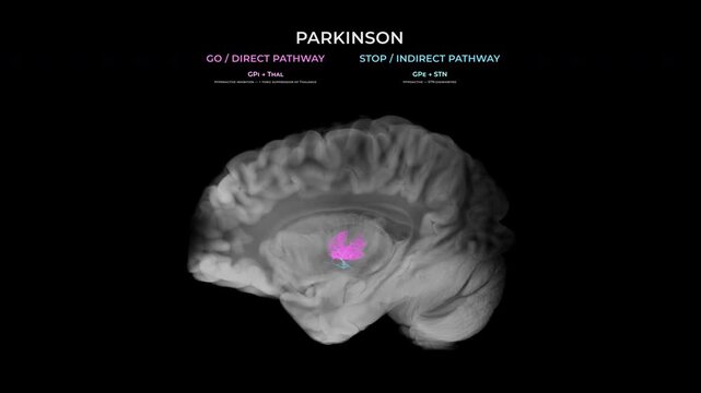 Parkinson Dopamine Loss Basal Ganglia Motor Circuit Transparent Sagittal View