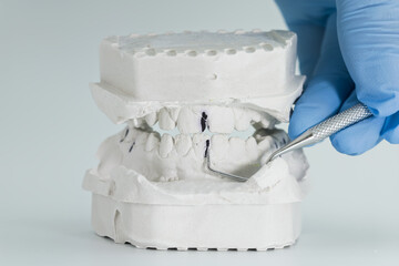 Dental plaster bite model examined with tool