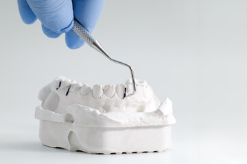 Dental tool examining plaster teeth model