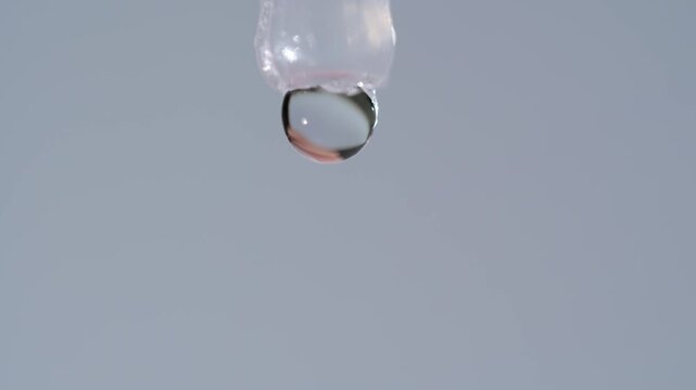 Close-up of a disposable eye drop vial administering a clear liquid solution into a person's open eye for hydration or medical treatment.