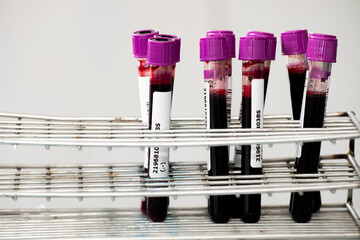 Close up of blood samples in test tubes with purple caps arranged in a metal rack at a laboratory. Medical analysis and health testing concept for diagnosis, research, and clinical examination.