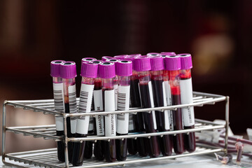 Close up of blood samples in test tubes with purple caps arranged in a metal rack at a laboratory. Medical analysis and health testing concept for diagnosis, research, and clinical examination.