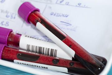 Close up of blood samples in test tubes with barcode labels and purple caps placed on medical documents in a laboratory, representing health testing, diagnostics, and medical analysis concept.