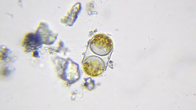 Two round cyanobacteria with nearby bacteria at 2000x (brightfield, oil immersion)