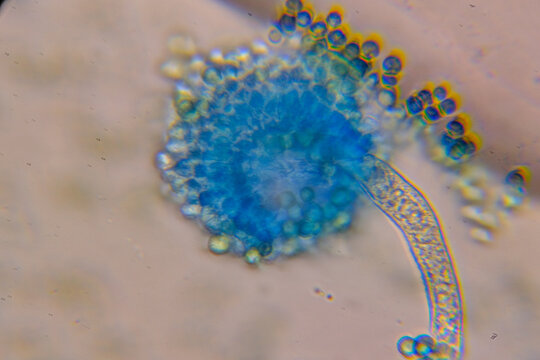 Microscopic view of Aspergillus conidiophore, stained blue, revealing spores and hyphal structure
