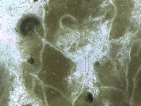 Unstained fungal structures: The radiating head of mold producing chains of conidia.