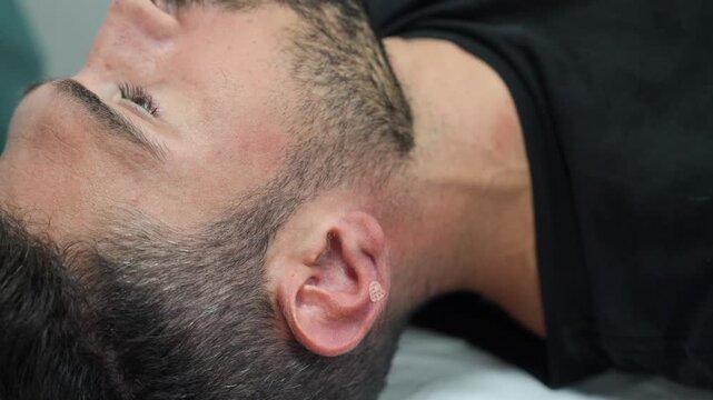 Dry Needling. Inserting small needle in the ear trigger points
