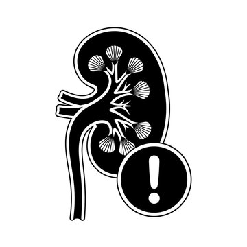 Illustration of a kidney with internal structures and an exclamation point in a circle below it icon