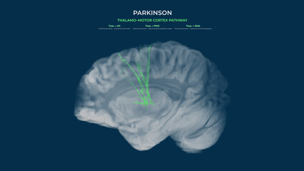 Parkinson Dopamine Loss Thalamo–Motor Cortex Pathway Hypoactivity Sagittal View
