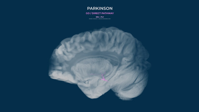 Parkinson Dopamine Deficiency Direct Neural Pathway Impairment in Sagittal View