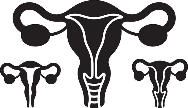 Black silhouette vector of female reproductive system anatomy with three uterus diagrams ovaries fallopian tubes