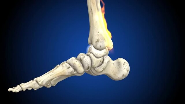 Animated Foot Skeleton with Inflammation Visualized on Blue Background