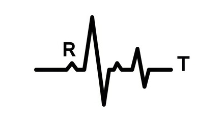Electrocardiogram heartbeat monitoring vector trace