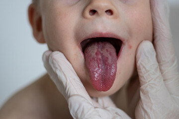 Close up of a pediatrician doctor checking a boys tongue and mouth