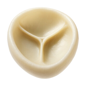 Two-cusp mitral valve with a smooth, translucent surface.