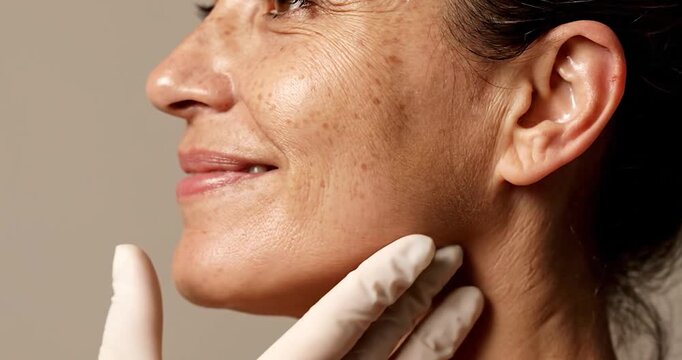 Female Endolift for Double Chin and Jawline Contouring. Aesthetics, skin tightening.
