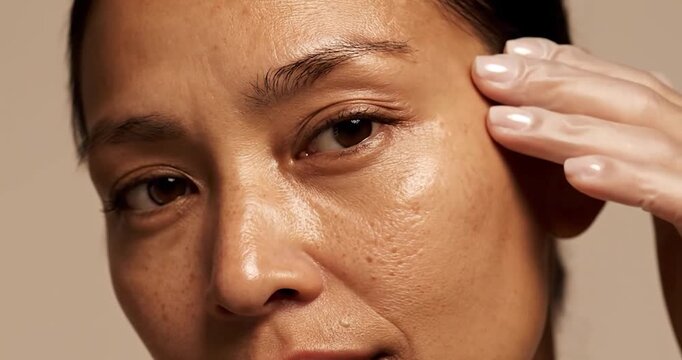 Botulinum Toxin for Expression Lines and Wrinkle Reduction. Anti-aging, aesthetic.