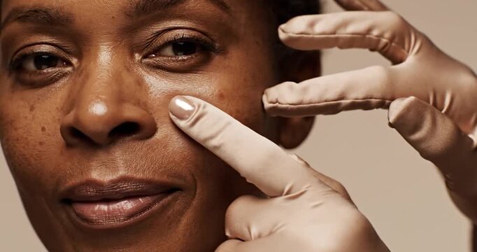 Laser Pigmentation Treatment for Dark Spots and Even Tone. Dermatology, beauty concept.