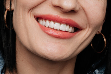 Macro closeup of perfect white porcelain veneers with glossy coral lipstick smile