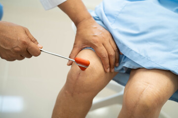 Doctor neurologist testing reflex knee with hammer and show Asian senior scars surgical total knee joint replacement.