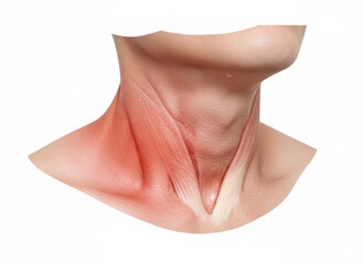 Neck anatomy body pain, tendon strain, skin texture, red inflammation