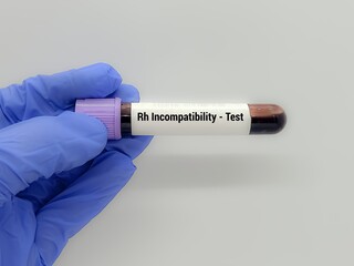 Obraz premium Doctor holding a test blood sample for Rh Incompatibility test. Laboratory medical testing concept.