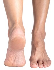 Close-up of bare feet showing skin texture and foot anatomy.