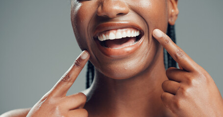 Teeth, dental wellness and woman point at mouth for oral health, fresh breath and gum care. Hands,...