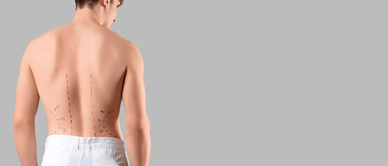 Naklejka premium Young man with markings on his back against grey background. Plastic surgery concept