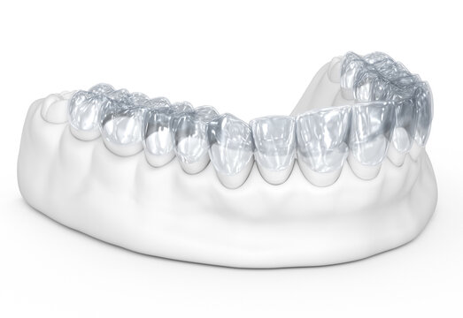 Invisalign braces or invisible retainer on white. Medically accurate dental 3D illustration