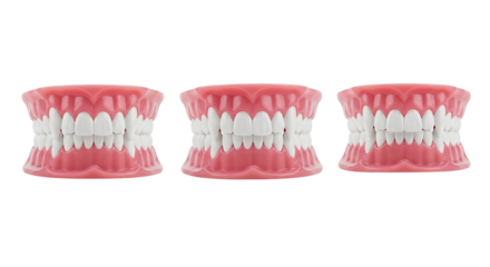Three Realistic Dentures Dental Prosthetics Artificial Teeth Medical Model Healthcare Oral on transparent background