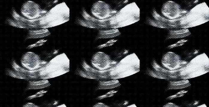 Ultrasound screen showing developing baby during third month of pregnancy in medical clinic